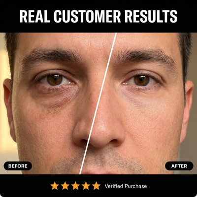 Solveta Eye Repair Stick