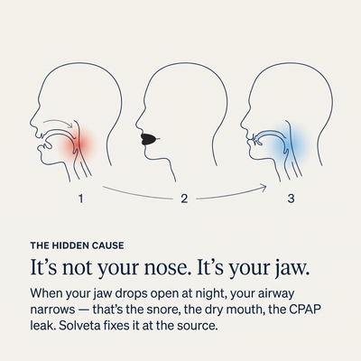 Solveta Sleep Strips