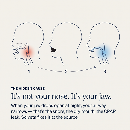 Solveta Sleep Strips